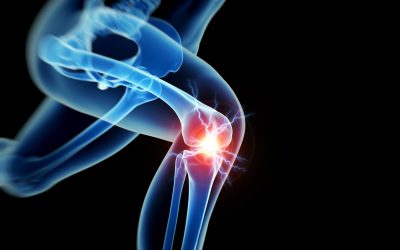 Do You Need Ankle Joint Replacement in Brainerd, MN?