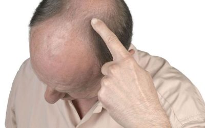 Regain confidence with proven hair loss treatments in Pine Bluff, AR