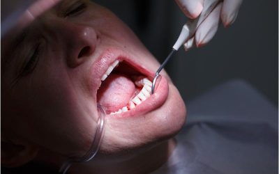 Quick Relief for Urgent Dental Needs: Emergency Dental Care in Spring Lake, NJ