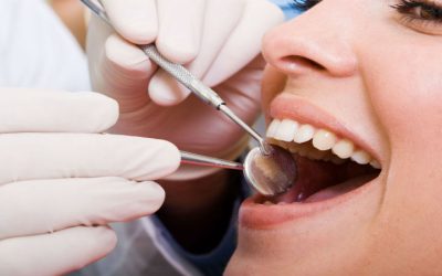 Why Using Dental Bridges in Melbourne FL To Replace Missing Teeth is Beneficial